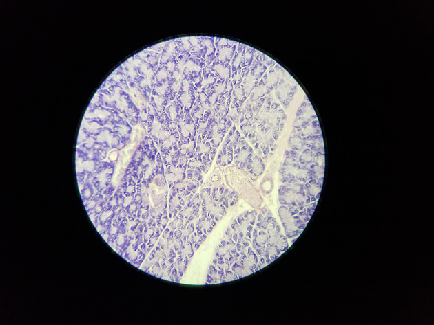 Pancreas Slides - Pancreas 011 100X